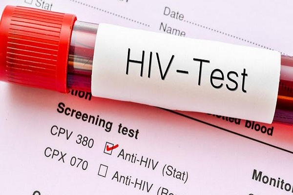 Hiv Test