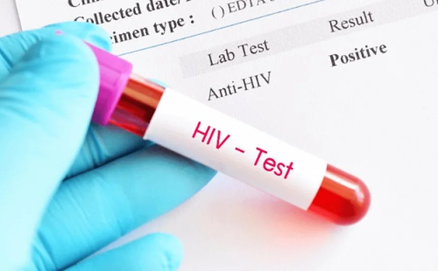 Over 11,400 Persons Living with HIV in Bono Region, Majority Are Women