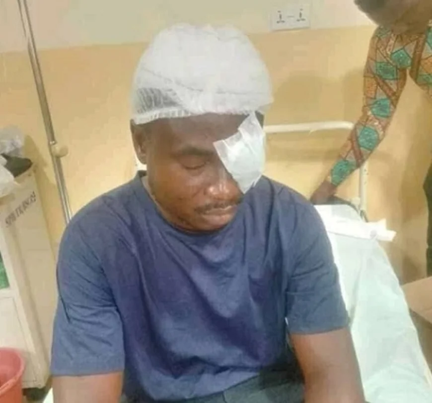 I regret choosing teaching – Asuoso SHS Teacher stabbed in eye by student speaks out