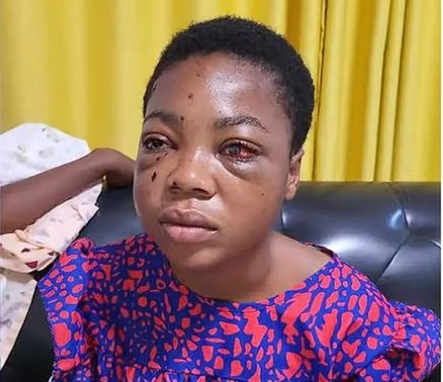 “Help Save My Daughter’s Sight” – Mother of 16-Year-Old SDA SHS Girl Hit by Stray Bullet Cries Out