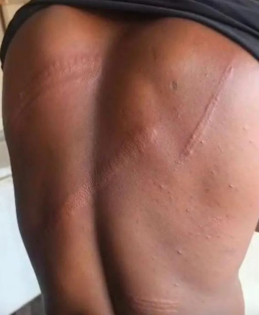 Journalists Under Attack: WAES Slams Military Brutality